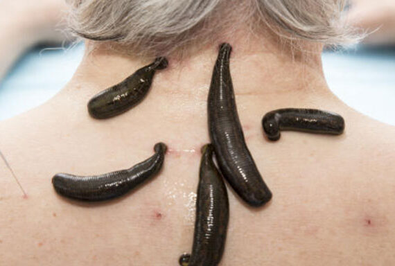 Nerve-Treatment