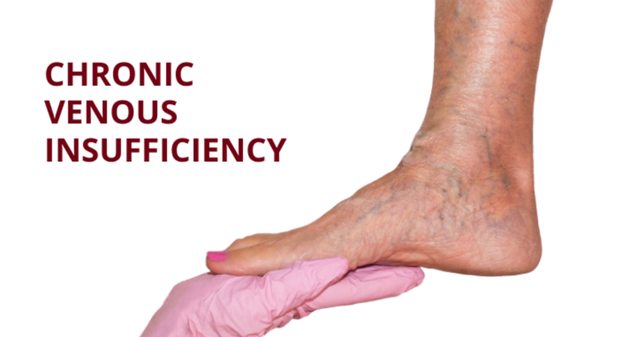 Chronic Venous