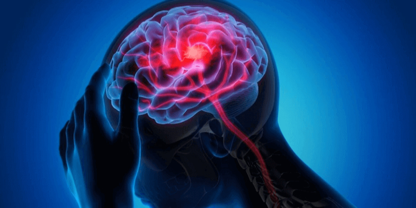 A Complete Guide to Living with and Managing Neurological Disorders