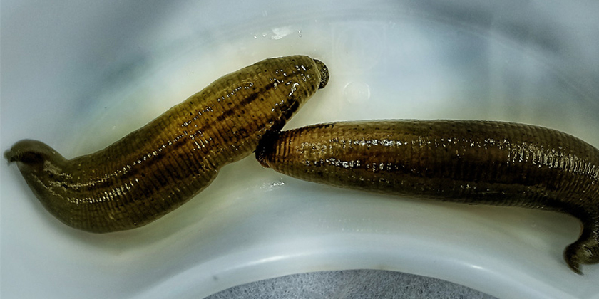 Leech Therapy and Its Potential Benefits for Female Infertility