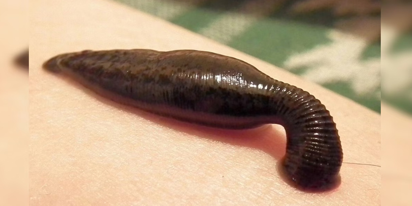 Leech Therapy as a Powerful Detox Treatment What Science Says