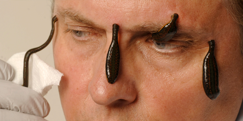 Leech Therapy for Skin Rejuvenation: A Revolutionary Natural Solution