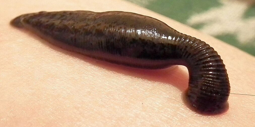 Leech-Treatment-for-Nerve-Regeneration-Everything-You-Need-to-Know