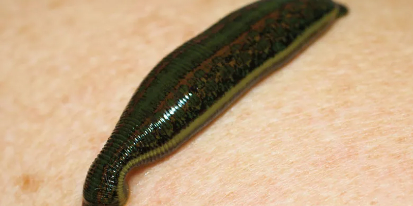 Liver Repair with Leeches: A Revolutionary Path to Recovery