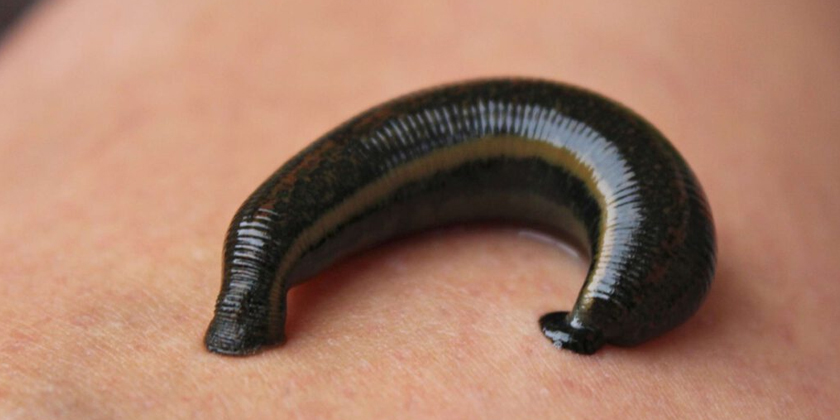 Leech Therapy for Detox The Science-Backed Way to Feel Rejuvenated