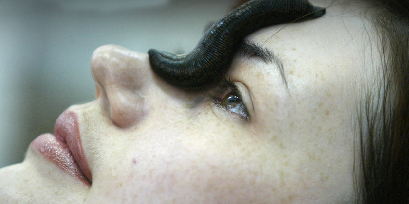 Leech Therapy for Flawless Skin: The Natural Secret Celebrities Swear By